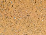 DUS2L Antibody in Immunohistochemistry (Paraffin) (IHC (P))