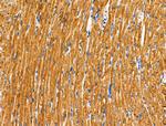 DUS2L Antibody in Immunohistochemistry (Paraffin) (IHC (P))