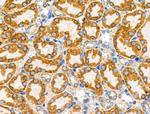 DUS2L Antibody in Immunohistochemistry (Paraffin) (IHC (P))