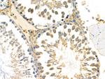 DUS2L Antibody in Immunohistochemistry (Paraffin) (IHC (P))