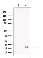 ECRG4 Antibody in Western Blot (WB)