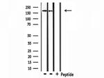 Collagen IV Antibody in Western Blot (WB)