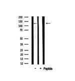 MAST2 Antibody in Western Blot (WB)