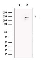 DGKH Antibody in Western Blot (WB)