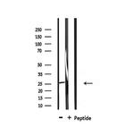 CHOP Antibody in Western Blot (WB)