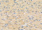 DAK Antibody in Immunohistochemistry (Paraffin) (IHC (P))