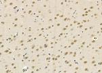 DAK Antibody in Immunohistochemistry (Paraffin) (IHC (P))