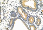 DAK Antibody in Immunohistochemistry (Paraffin) (IHC (P))