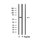 DAK Antibody in Western Blot (WB)