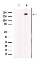 ALPK2 Antibody in Western Blot (WB)