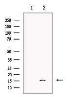 RBP5 Antibody in Western Blot (WB)