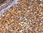 AKT Pan Antibody in Immunohistochemistry (Paraffin) (IHC (P))