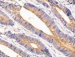 AKT Pan Antibody in Immunohistochemistry (Paraffin) (IHC (P))