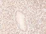 Phospho-JAK1 (Tyr1034) Antibody in Immunohistochemistry (Paraffin) (IHC (P))