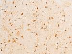 Phospho-GSK3B (Ser9) Antibody in Immunohistochemistry (Paraffin) (IHC (P))