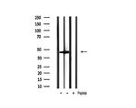 Phospho-GSK3B (Ser9) Antibody in Western Blot (WB)