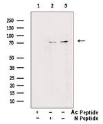 Acetyl-FOXO1 (Lys294) Antibody in Western Blot (WB)