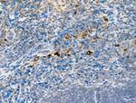 Phospho-DDR1 (Tyr513) Antibody in Immunohistochemistry (Paraffin) (IHC (P))