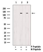 Phospho-DDR1 (Tyr513) Antibody in Western Blot (WB)