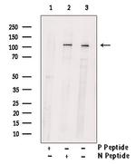 Phospho-PKD2 (Ser812) Antibody in Western Blot (WB)