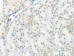 Phospho-RUNX1 (Ser249) Antibody in Immunohistochemistry (Paraffin) (IHC (P))