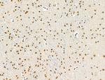 Phospho-RUNX1 (Ser249) Antibody in Immunohistochemistry (Paraffin) (IHC (P))