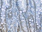 Phospho-RUNX1 (Ser249) Antibody in Immunohistochemistry (Paraffin) (IHC (P))