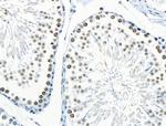 Phospho-RUNX1 (Ser249) Antibody in Immunohistochemistry (Paraffin) (IHC (P))