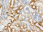 Phospho-AS160 (Ser318) Antibody in Immunohistochemistry (Paraffin) (IHC (P))