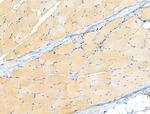 Phospho-AS160 (Ser318) Antibody in Immunohistochemistry (Paraffin) (IHC (P))