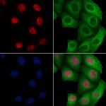 Phospho-BCL9L (Ser915) Antibody in Immunocytochemistry (ICC/IF)