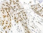 Phospho-BCL9L (Ser915) Antibody in Immunohistochemistry (Paraffin) (IHC (P))