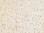 Phospho-BCL9L (Ser915) Antibody in Immunohistochemistry (Paraffin) (IHC (P))