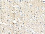 Phospho-BCL9L (Ser915) Antibody in Immunohistochemistry (Paraffin) (IHC (P))