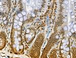 Phospho-BCL9L (Ser915) Antibody in Immunohistochemistry (Paraffin) (IHC (P))