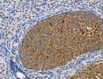 Phospho-Beclin 1 (Ser15) Antibody in Immunohistochemistry (Paraffin) (IHC (P))