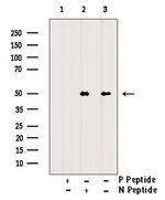 Phospho-CaMKII alpha/beta/delta (Tyr231) Antibody in Western Blot (WB)