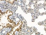 Phospho-CENPA (Ser7) Antibody in Immunohistochemistry (Paraffin) (IHC (P))