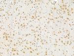 Phospho-CENPA (Ser7) Antibody in Immunohistochemistry (Paraffin) (IHC (P))