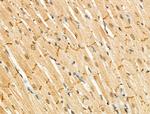 Phospho-CTDSPL2 (Ser104) Antibody in Immunohistochemistry (Paraffin) (IHC (P))