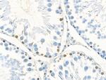 Phospho-CTDSPL2 (Ser104) Antibody in Immunohistochemistry (Paraffin) (IHC (P))