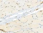 Phospho-CTDSPL2 (Ser104) Antibody in Immunohistochemistry (Paraffin) (IHC (P))