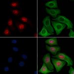 Phospho-Cyclin E (Thr77) Antibody in Immunocytochemistry (ICC/IF)