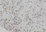 Phospho-Cyclin E (Thr77) Antibody in Immunohistochemistry (Paraffin) (IHC (P))