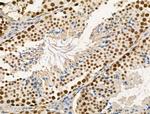 Phospho-DAB1 (Tyr220) Antibody in Immunohistochemistry (Paraffin) (IHC (P))