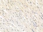 Phospho-EEF2K (Ser366) Antibody in Immunohistochemistry (Paraffin) (IHC (P))