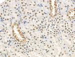 Phospho-EEF2K (Ser366) Antibody in Immunohistochemistry (Paraffin) (IHC (P))