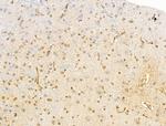 Phospho-EEF2K (Ser366) Antibody in Immunohistochemistry (Paraffin) (IHC (P))