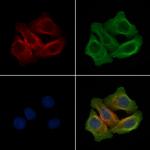 Phospho-FLT3 (Tyr969) Antibody in Immunocytochemistry (ICC/IF)