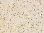 Phospho-FOXO3A (Ser7) Antibody in Immunohistochemistry (Paraffin) (IHC (P))